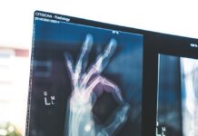 튼튼한 뼈, 건강한 삶…골다공증 예방과 뼈 건강 관리법 citiscan result hand ok